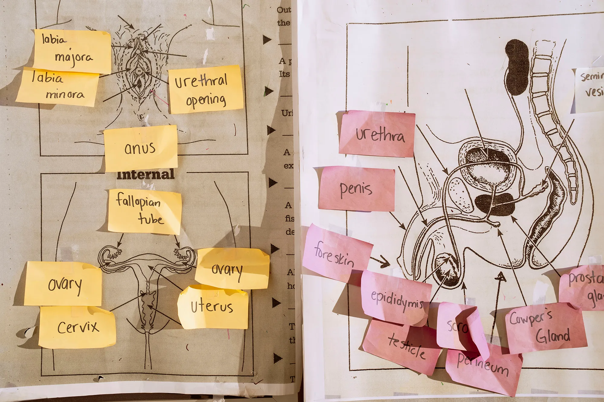 Detail of male and female genitalia with small Post-It Notes labeling body parts.